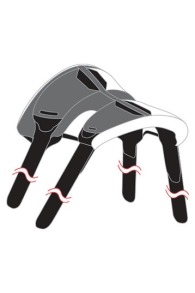 Naish-Apex Fixations